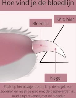 Professionele Nagelschaar | Nagelschaar Hond | Nagelschaar Kat | Nagelknipper Hond En Kat | Nagelknipper Kat| Nagelknipper Hond | NagelTang Dieren | Poot Verzorging 10 Professionele Nagelschaar | Nagelschaar Hond | Nagelschaar Kat | Nagelknipper Hond En Kat | Nagelknipper Kat| Nagelknipper Hond | NagelTang Dieren | Poot Verzorging -Hondenbenodigdheden 942x1200